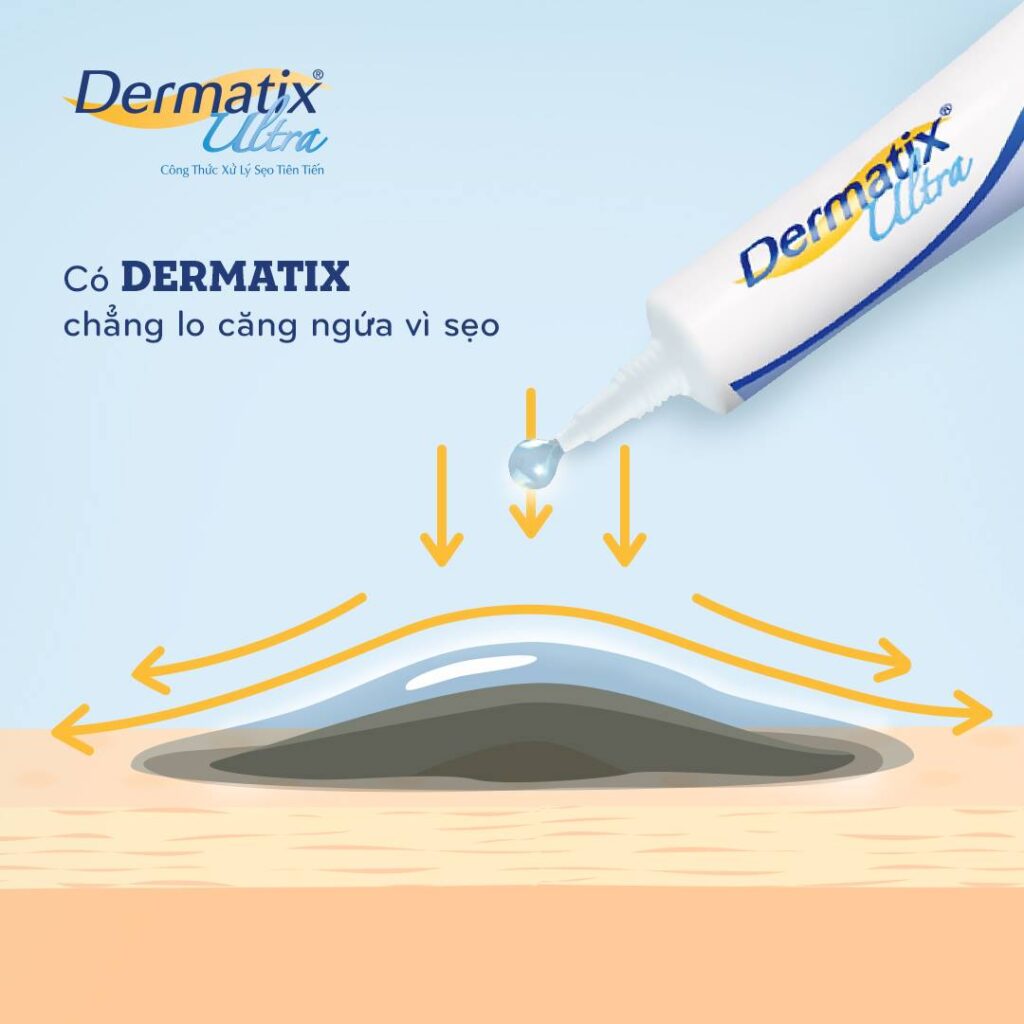 thuốc trị sẹo lồi dermatix